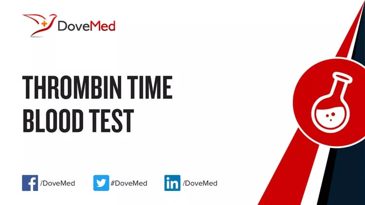 Thrombin Time Blood Test