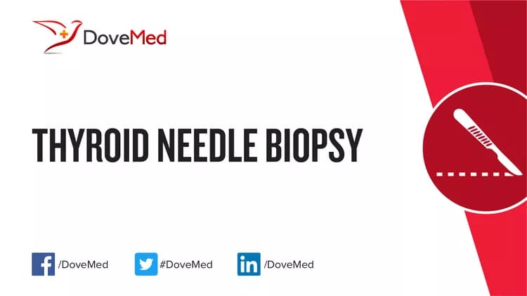 Thyroid Needle Biopsy