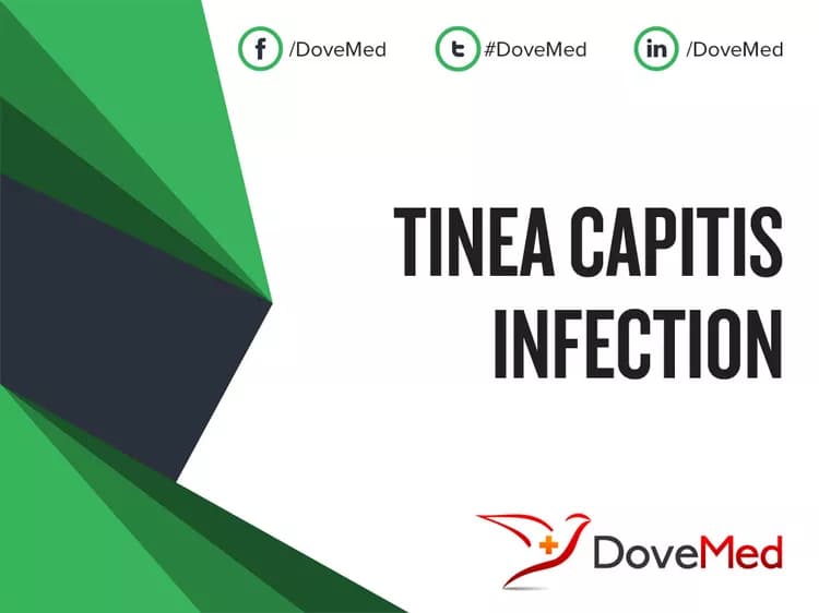 Can you access healthcare professionals in your community to manage Tinea Capitis Infection?