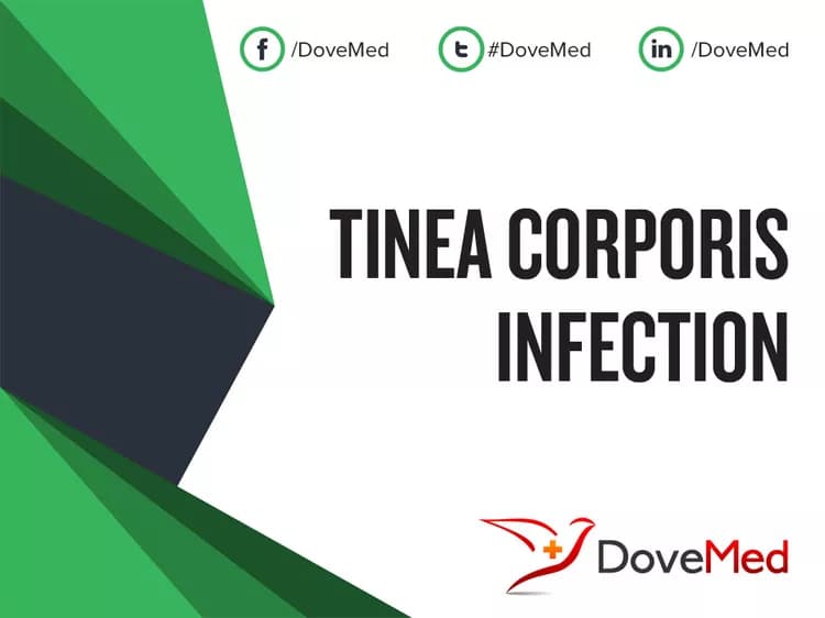 Is the cost to manage Tinea Corporis Infection in your community affordable?