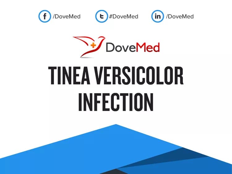 Tinea Versicolor Infection - DoveMed