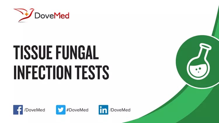 Tissue Fungal Infection Tests