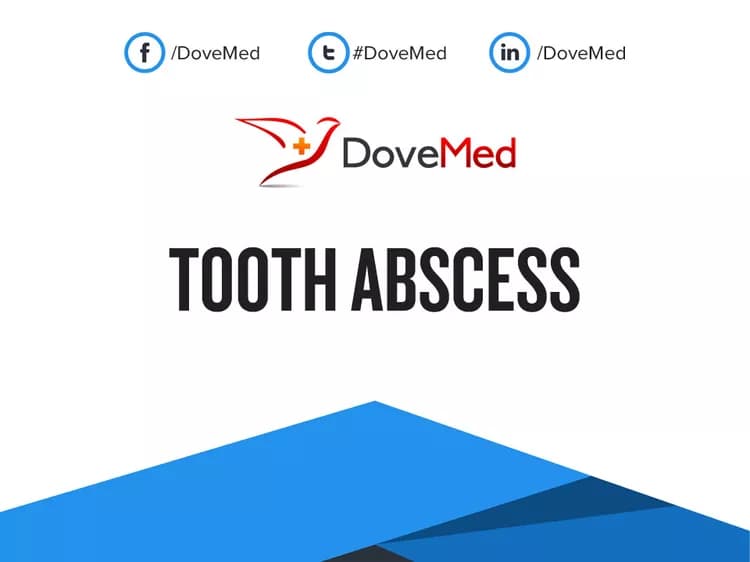 Are you satisfied with the quality of care to manage Tooth Abscess in your community?