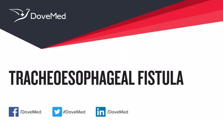 Can you access healthcare professionals in your community to manage Tracheoesophageal Fistula?