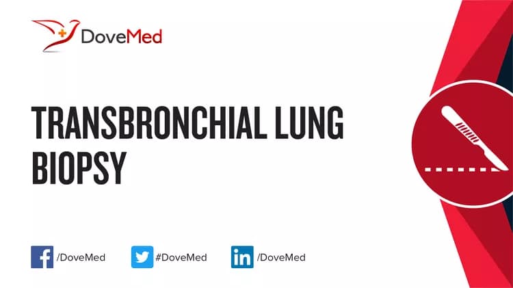 Transbronchial Lung Biopsy