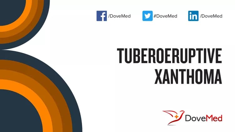 Can you access healthcare professionals in your community to manage Tuberoeruptive Xanthoma?