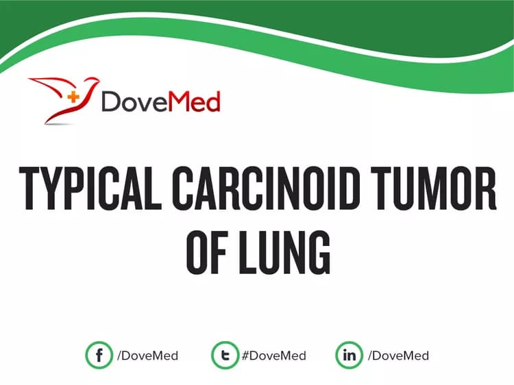 Is the cost to manage Typical Carcinoid Tumor of Lung in your community affordable?