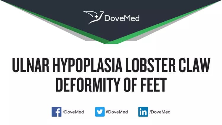 Ulnar Hypoplasia Lobster Claw Deformity of Feet
