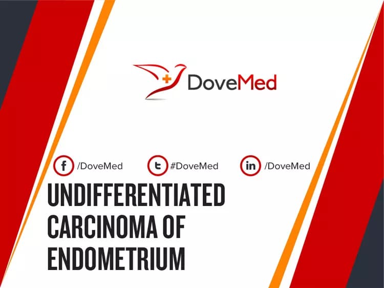 Can you access healthcare professionals in your community to manage Undifferentiated Carcinoma of Endometrium?