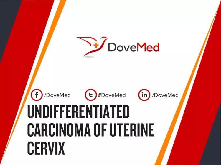 Can you access healthcare professionals in your community to manage Undifferentiated Carcinoma of Uterine Cervix?