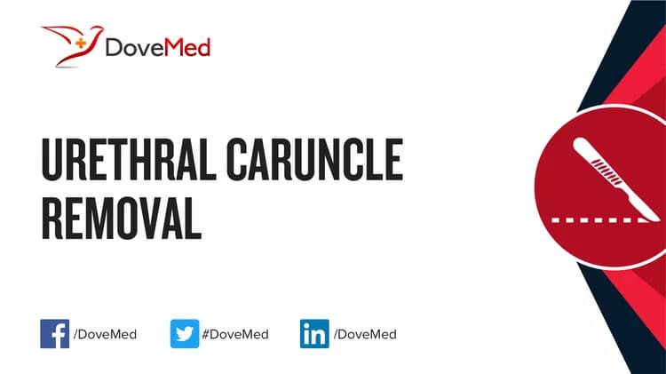 Urethral Caruncle Removal