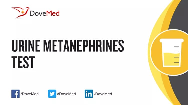 Urine Metanephrines Test