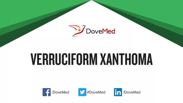Can you access healthcare professionals in your community to manage Verruciform Xanthoma?