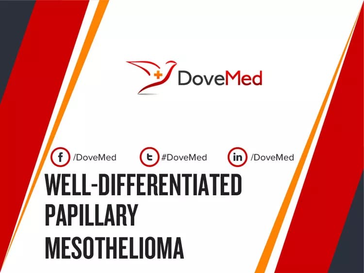 Can you access healthcare professionals in your community to manage Well-Differentiated Papillary Mesothelioma?
