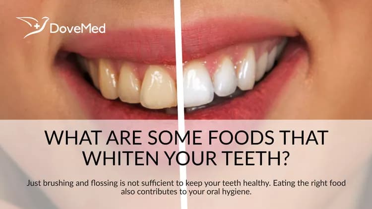 What Are Some Foods That Whiten Your Teeth?
