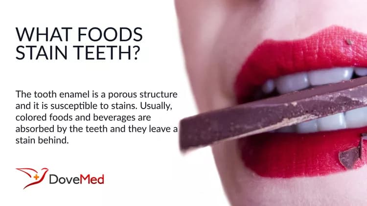 What Foods Stain Teeth?