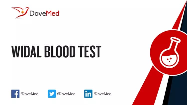 Widal Blood Test