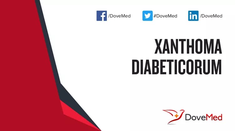 Can you access healthcare professionals in your community to manage Xanthoma Diabeticorum?