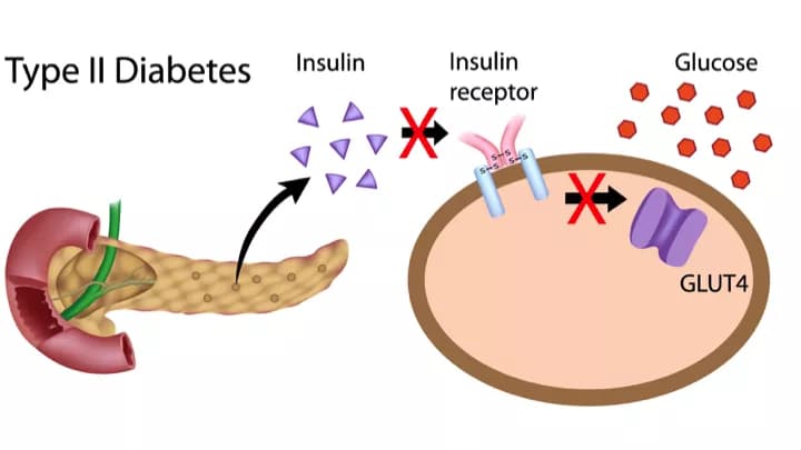 Vitamin Nicotinamide Riboside Protects Mice From Diabetes Complications
