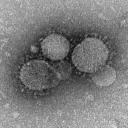 Middle East Respiratory Syndrome (MERS)