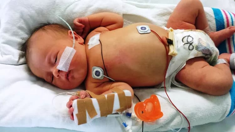 First Look At Potentially Deadly Metabolic Disorder That Strikes Infants