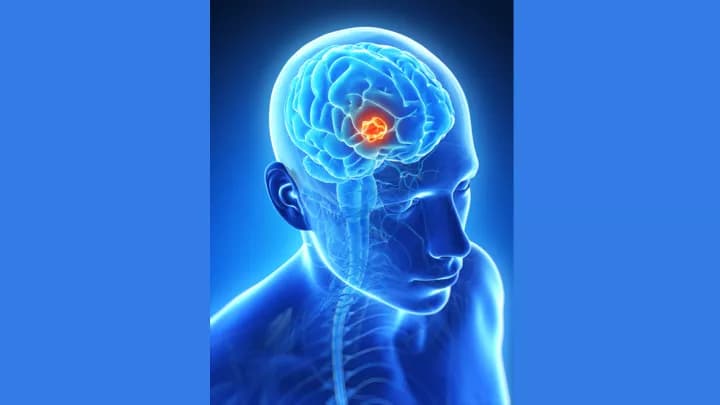 Tumor Growth Parameters Predict Response To Anti-angiogenic Therapy In Mice