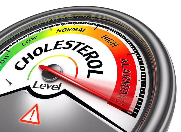 Cholesterol Crystals Are Sure Sign A Heart Attack May Loom