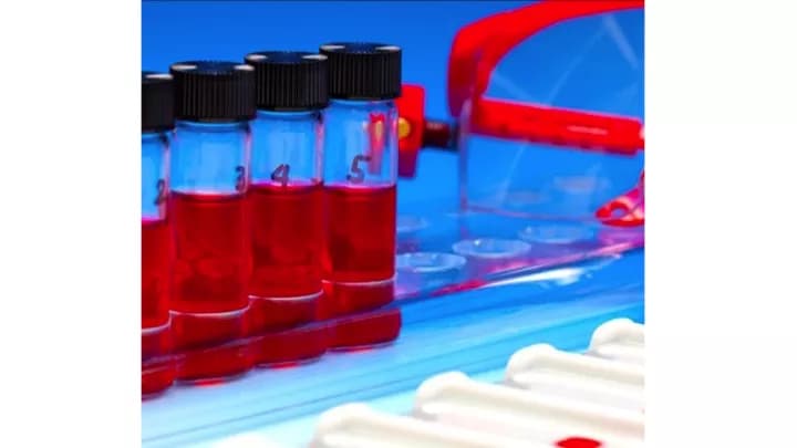 Sjögren’s Syndrome-B Extractable Nuclear Antibodies Blood Test