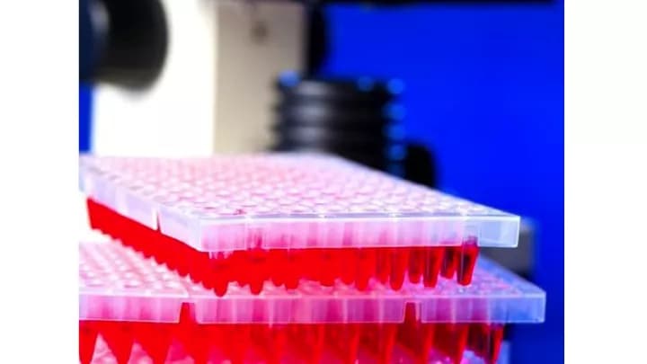 Sjögren’s Syndrome-A Extractable Nuclear Antibodies Blood Test
