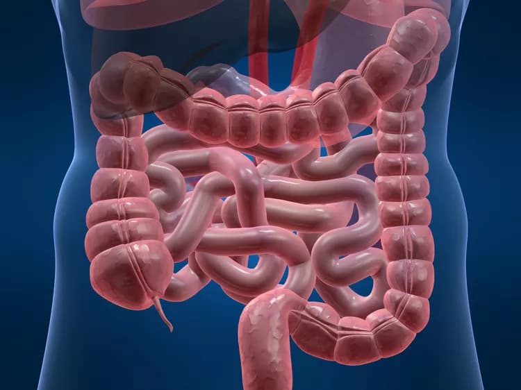 Preventing Colon Polyps: Another Reason To Lose Those Holiday Pounds