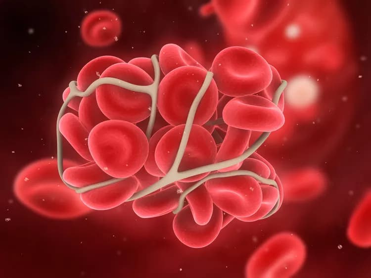 Small Molecule Prevents Blood Clots Without Increasing Bleeding Risk
