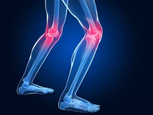 Fiber-Rich Diet Linked To Lowered Risk Of Painful Knee Osteoarthritis