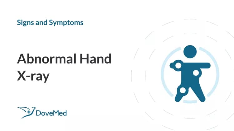Abnormal Hand X-ray - DoveMed