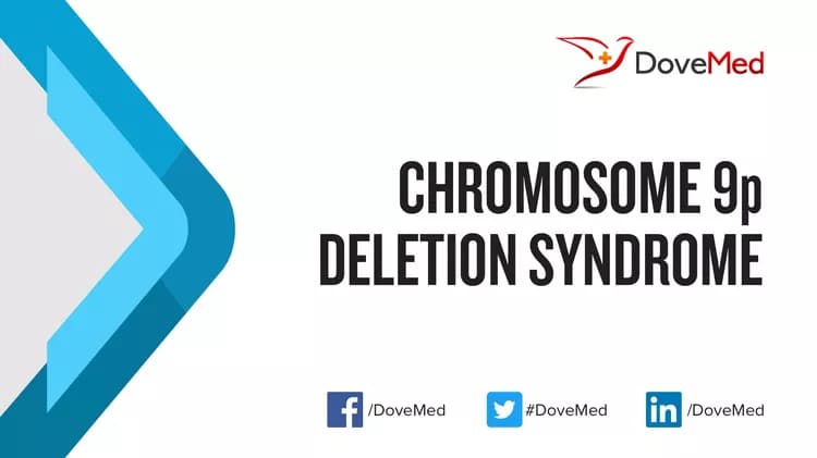 Chromosome 9p Deletion Syndrome - DoveMed