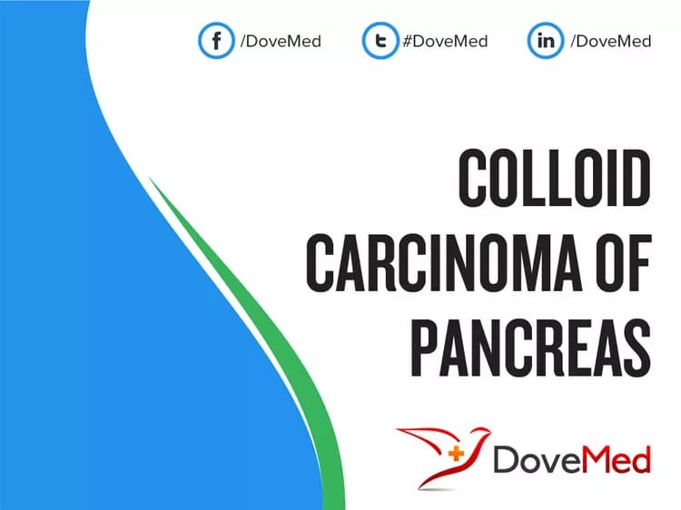Colloid Carcinoma of Pancreas - DoveMed
